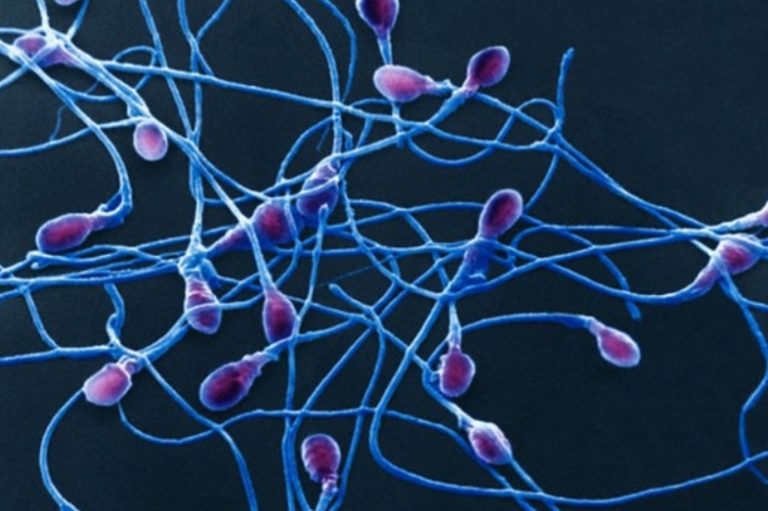 Will semen volume decrease after a vasectomy austin vasectomy center